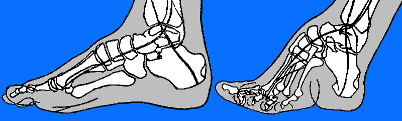 A diagram displaying a skeletal comparison of how women's feet were broken to appear smaller.